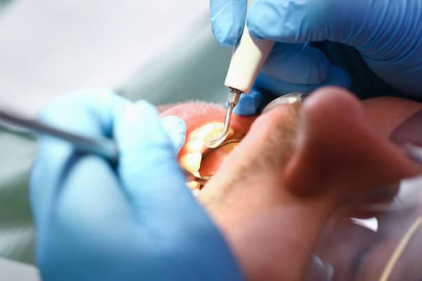 Best Emergency Gum Pain Relief  in Fulton, MS